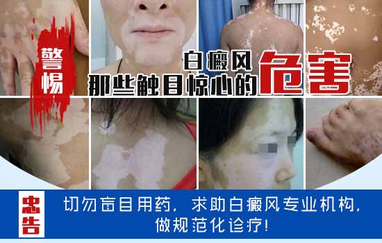 危害.jpg