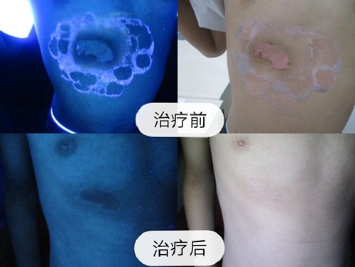 北京高级专家公益门诊暨白癜风公益大筛查 3.jpg